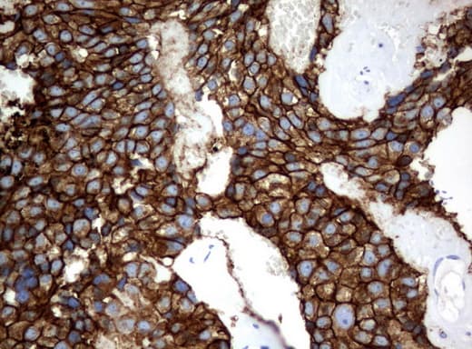 CA12 / Carbonic Anhydrase XII Antibody (clone UMAB121)