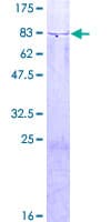 Human GHDC Protein (Recombinant GST)