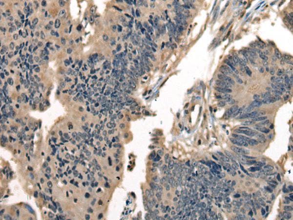 Polyclonal Rabbit anti-Human DNAJC2 / ZRF1 Antibody (IHC)