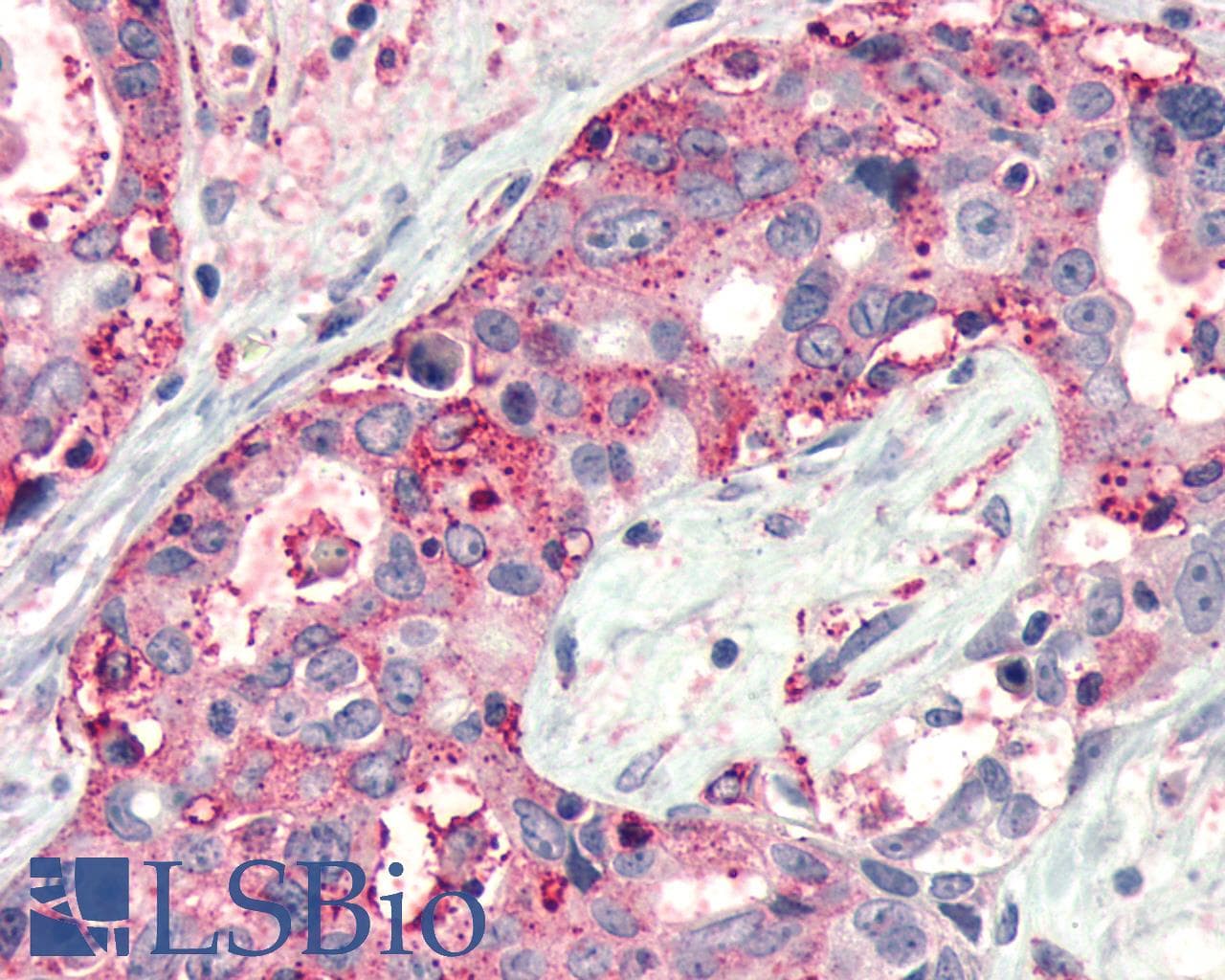 PathPlus™ FZD4 / Frizzled 4 Antibody (C-Terminus)