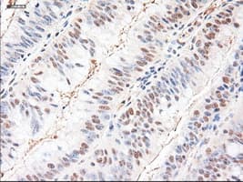 NTF3 / Neurotrophin 3 Antibody (clone OTI5C7)
