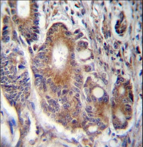 Polyclonal Rabbit anti-Human RAB21 Antibody (aa168-197, IHC, WB)