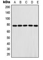 IHC-plus™ FBLN1 / Fibulin 1 Antibody (Internal)