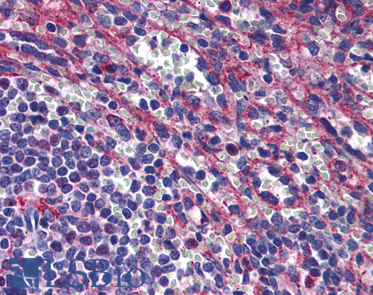 IHC-plus™ PLIN3 / M6PRBP1 / TIP47 Antibody (clone 2F7)