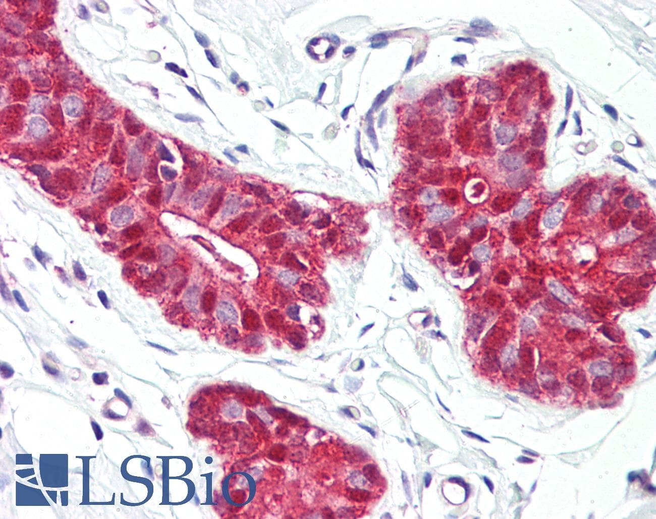 IHC-plus™ AKT1 + AKT2 + AKT3 Antibody (aa281-330)