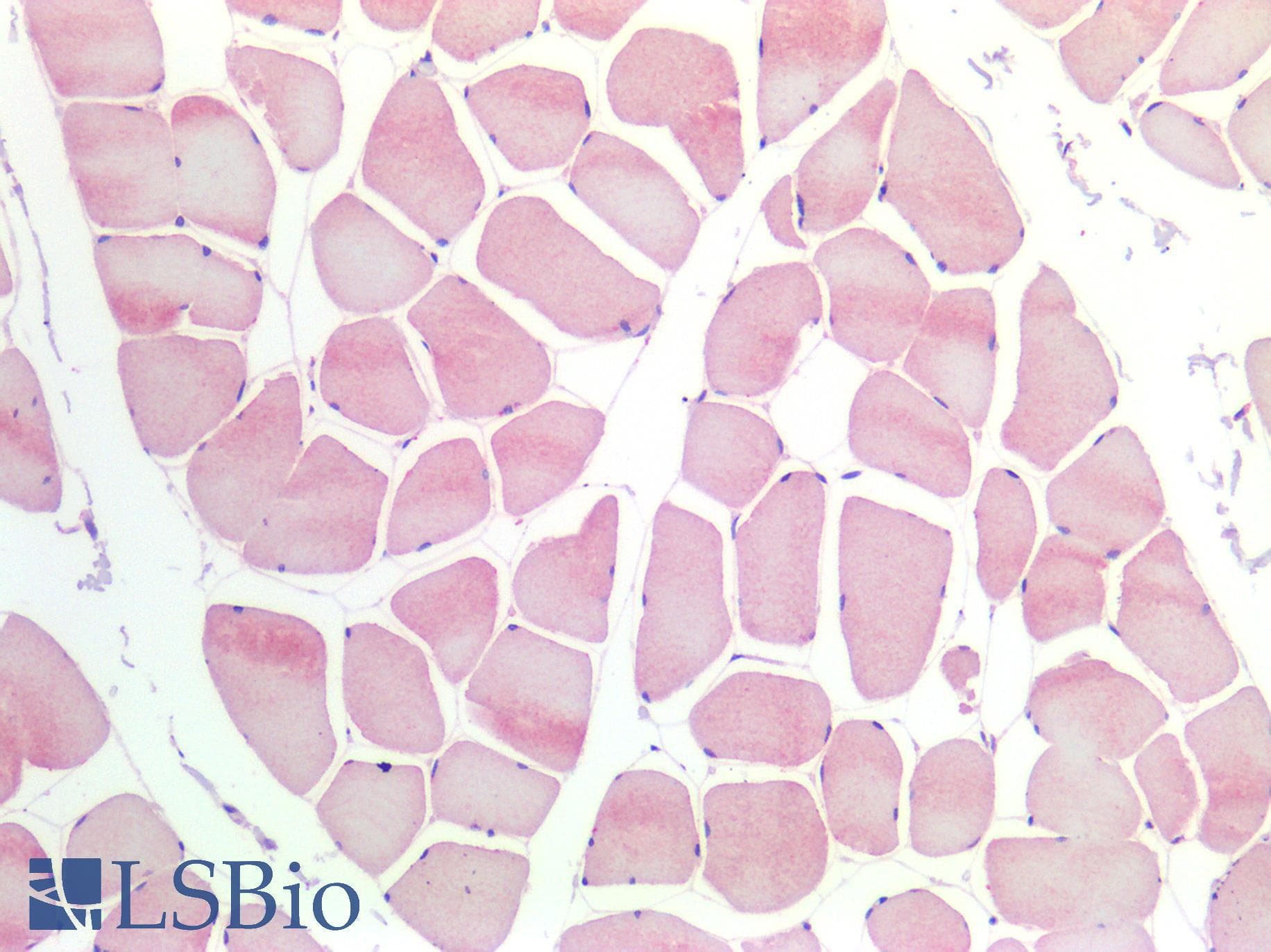 IHC-plus™ ACHE / Acetylcholinesterase Antibody