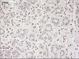 VEGFA / VEGF Antibody (clone OTI2F7)
