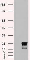 NEUROG1 / NGN1 / Neurogenin 1 Antibody (clone OTI19A11)