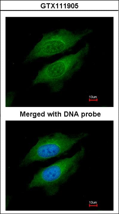 IHC-plus™ Polyclonal Rabbit anti-Human Dipeptidylpeptidase 8 / DPP8 Antibody (IHC, IF, WB)
