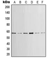 p56lck / LCK Antibody (Internal)