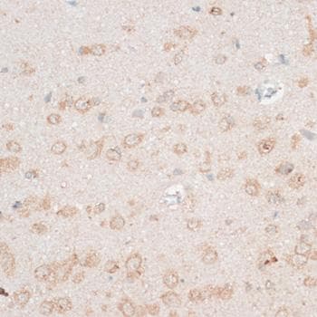 CDH18 / Ey-Cadherin Antibody