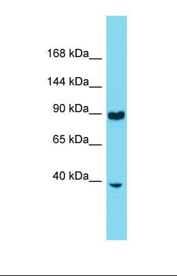 RNF216 / TRIAD3 Antibody (aa101-150)