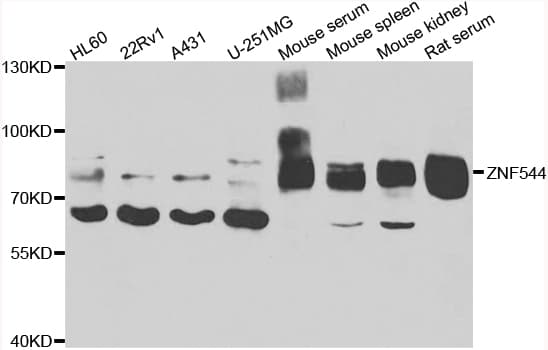 Polyclonal Rabbit anti-Human ZNF544 Antibody (IHC, WB)