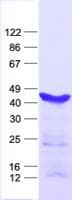 Human STRADA / LYK5 Protein (Recombinant His, N-Terminal)
