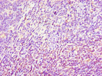 Polyclonal Rabbit anti-Human AKR1C4 / Chlordecone Reductase Antibody (aa1-323, IHC, WB)