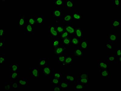 Polyclonal Rabbit anti-Human HIST1H4I Antibody (IF)