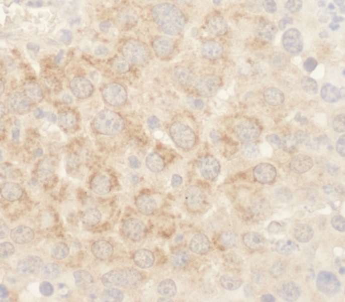 BAD Antibody (aa1-50)