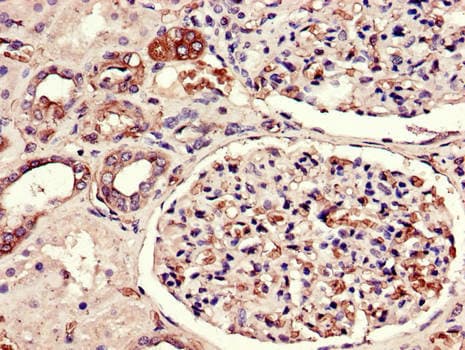 FLT1 / VEGFR1 Antibody