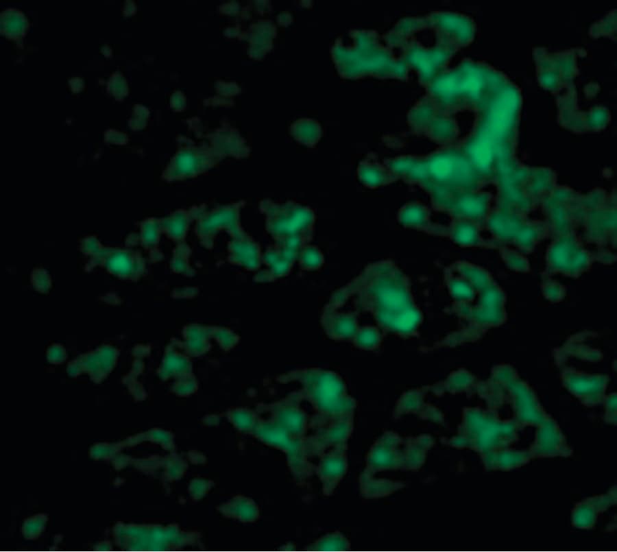 IHC-plus™ Polyclonal Rabbit anti-Human C1QTNF1 / CTRP1 Antibody (IHC, IF, WB)
