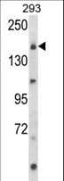 UNC13B Antibody (aa1062-1091)