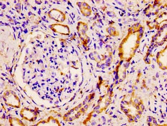 PNPLA6 / NTE Antibody