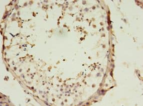 SLC13A4 Antibody (HRP)