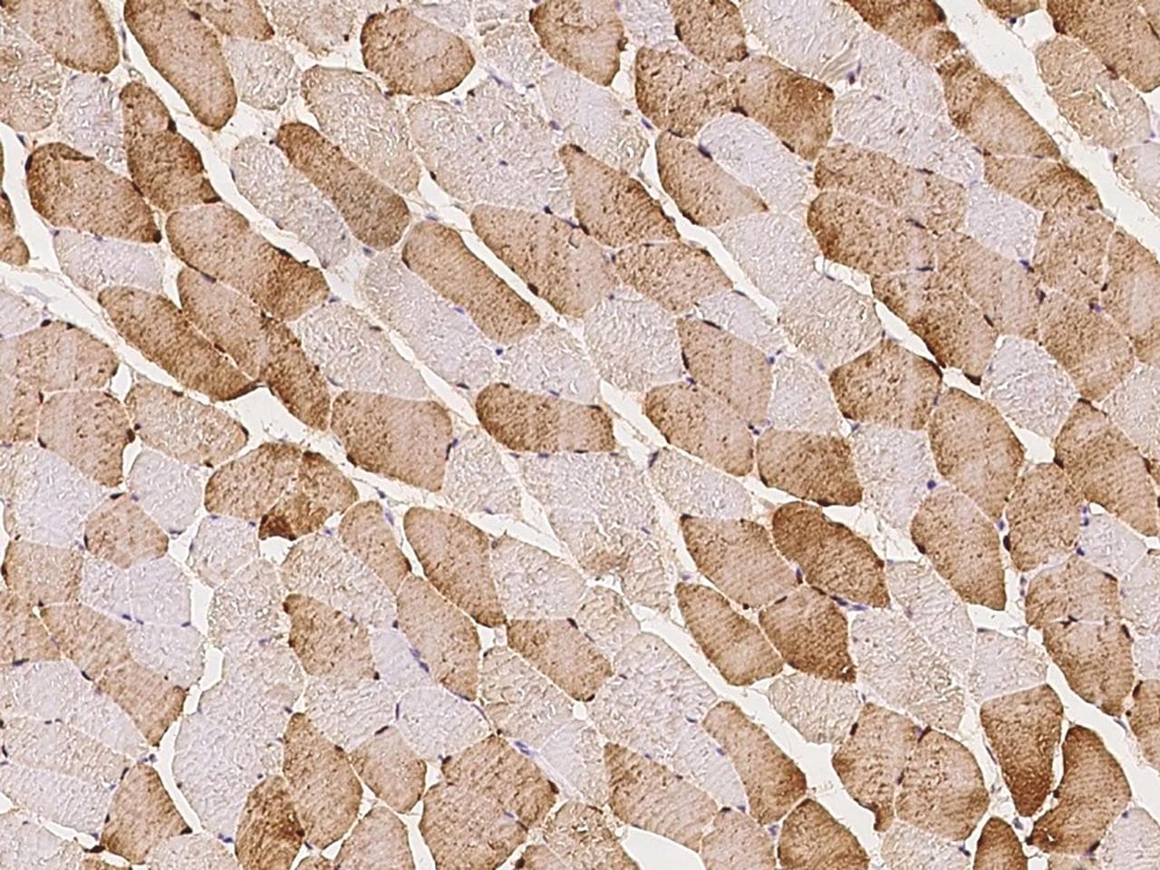 CSRP3 Antibody