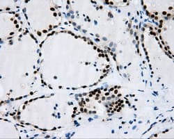 RPA2 / RFA2 / RPA34 Antibody (clone OTI9A1)