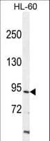 ITIH1 Antibody (aa606-635)