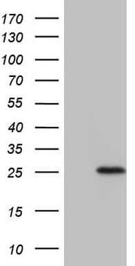 TNFRSF18 / GITR Antibody (aa26-162, clone OTI5G4)