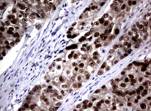 JUN / c-Jun Antibody (clone UMAB67)
