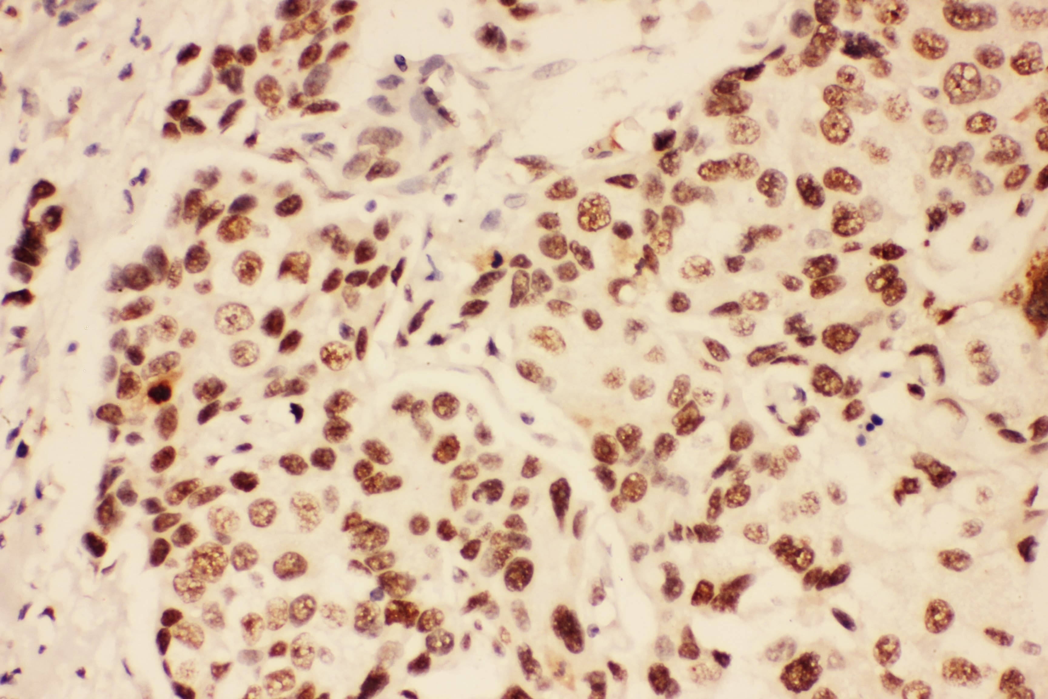 BRCA1 Antibody (aa1661-1863)