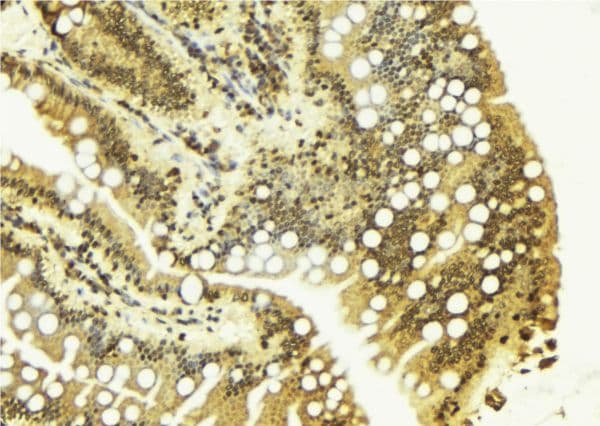 Polyclonal Rabbit anti-Human CHEK2 / CHK2 Antibody (IHC, IF, WB)