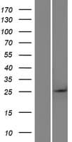 BTG4 Protein (Over-Expression Lysate Myc-DDK (Flag))