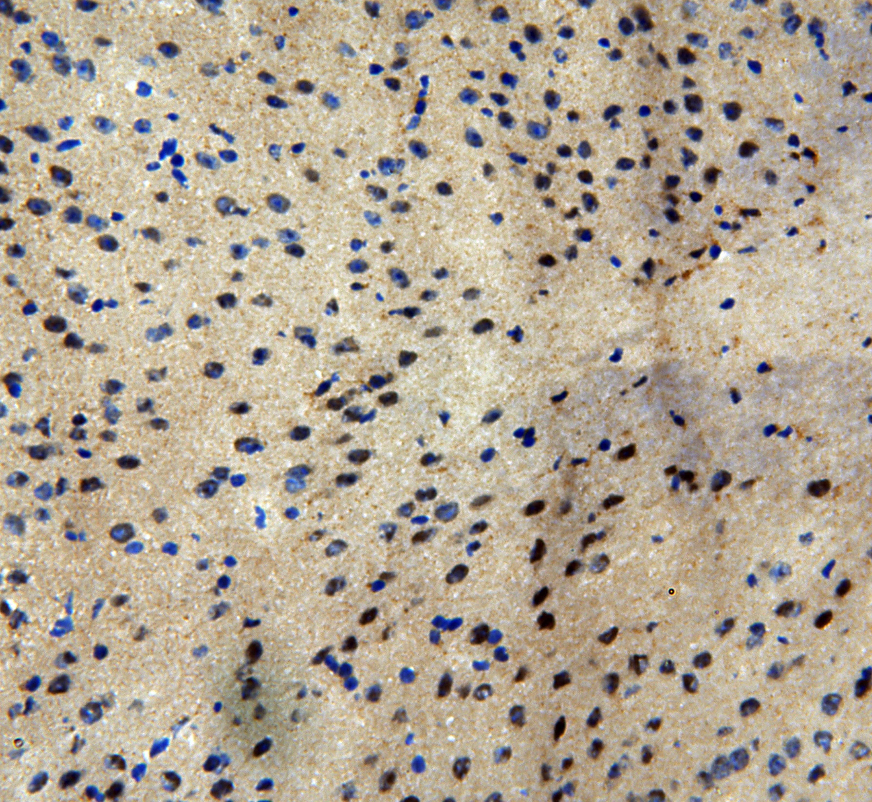 Polyclonal Rabbit anti-Human MTA1 Antibody (aa676-696, IHC, WB)