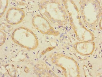 SLC1A7 / EAAT5 Antibody