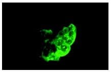 Stem Cell Marker TRA-1-81 Antibody (clone TRA-1-81)