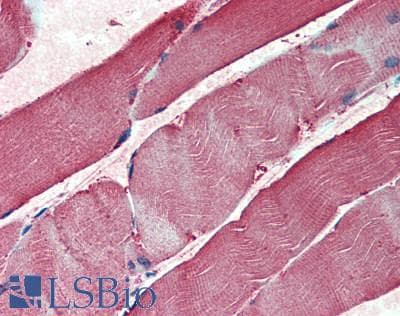 IHC-plus™ Monoclonal Mouse anti-Human TPI1 / TPI Antibody (IHC, WB)