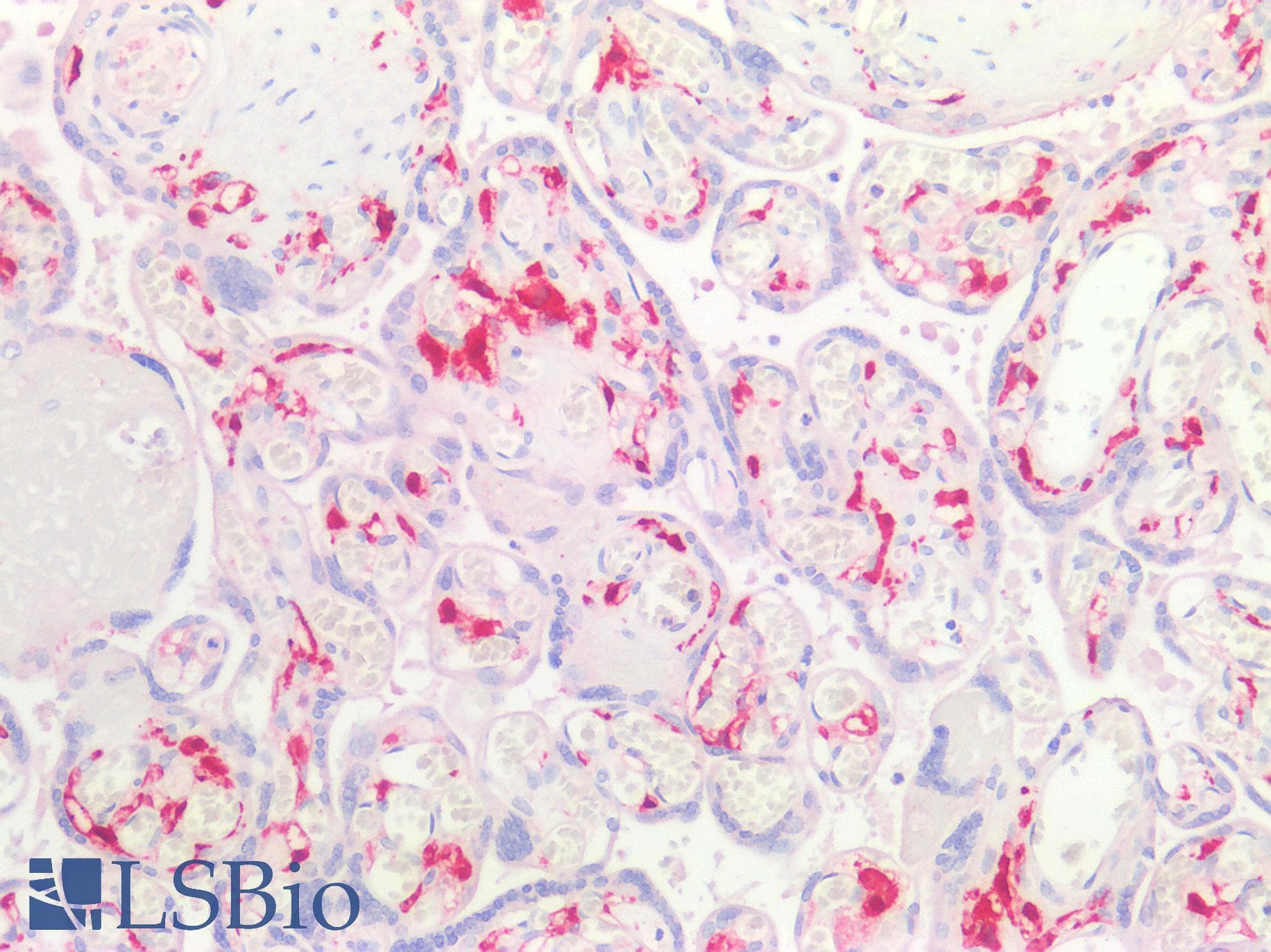 IHC-plus™ F13A1 / Factor XIIIa Antibody