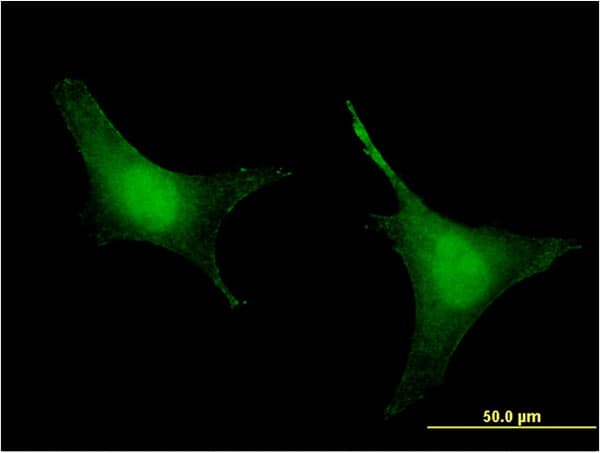 PREP / Prolyl Endopeptidase Antibody (clone 2D7)