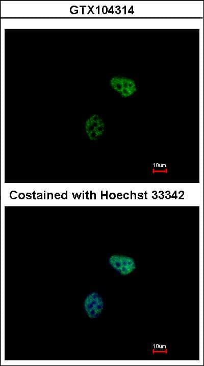 PSMC6 Antibody (aa1-301)