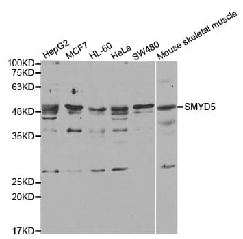 Polyclonal Rabbit anti-Human SMYD5 Antibody (IHC, IF, WB)