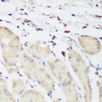 Polyclonal Rabbit anti-Human PLEK / Pleckstrin Antibody (IHC, WB)