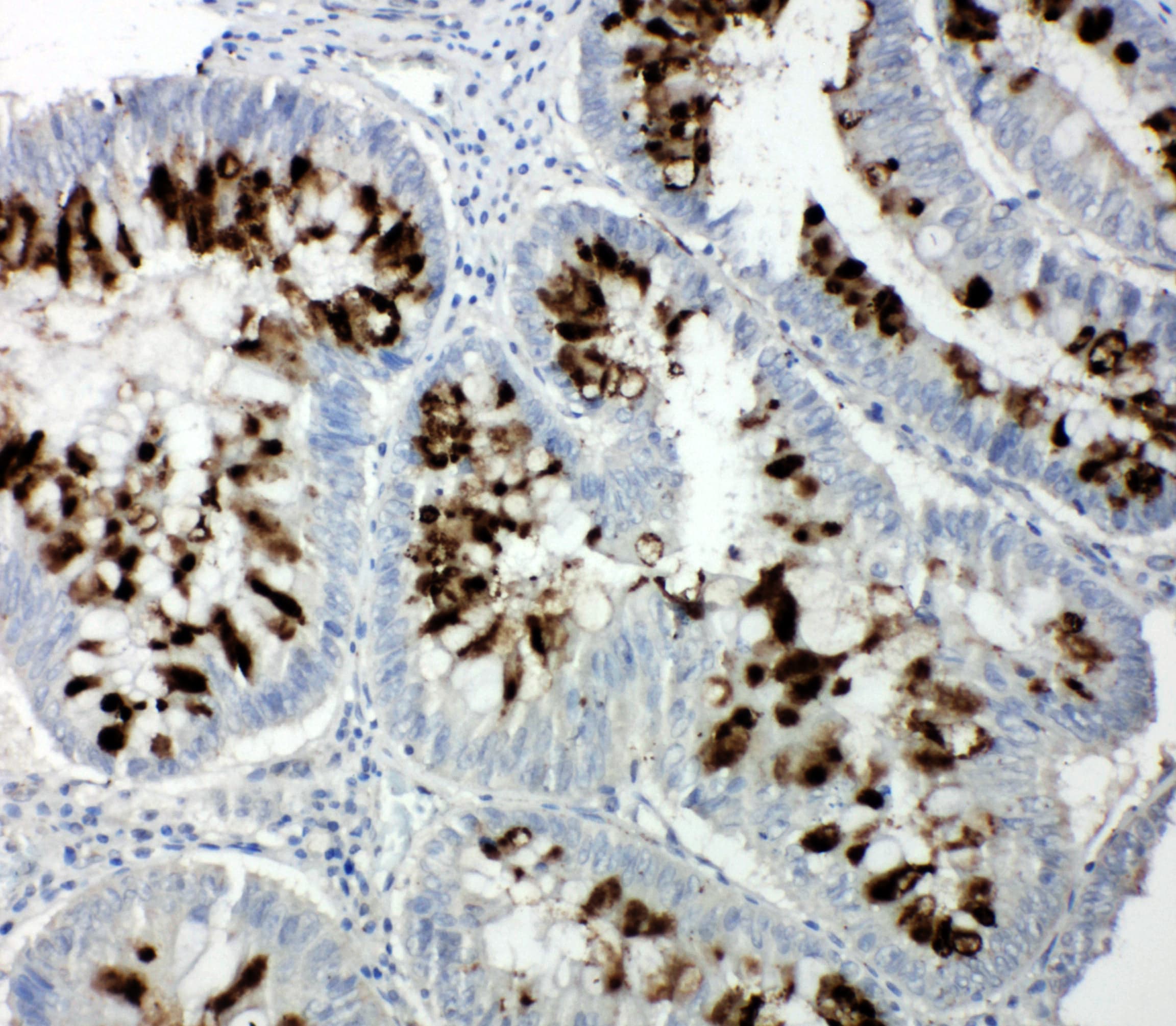 RBL1 / p107 Antibody (aa1048-1068)