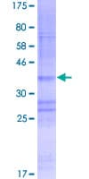 Human CLLU1 Protein (Recombinant GST)
