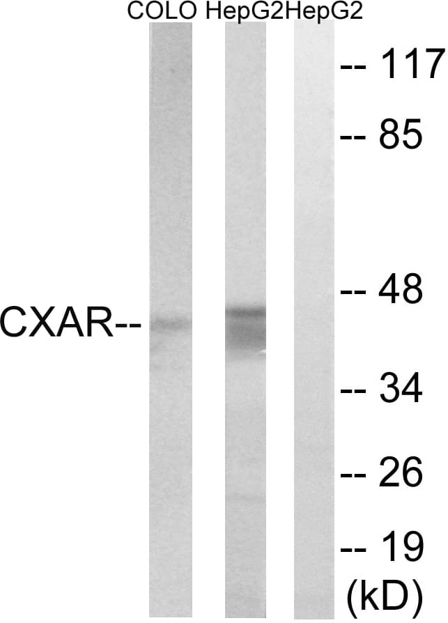 IHC-plus™ CXADR Antibody (aa1-50)