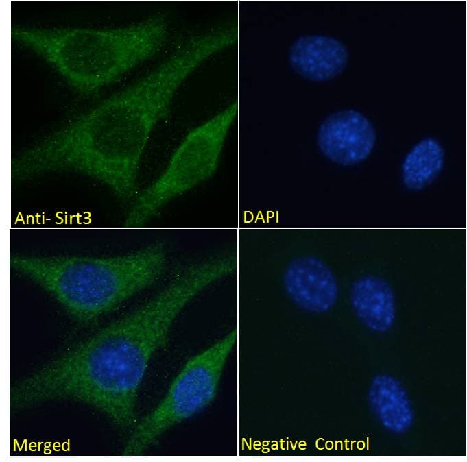 SIRT3 / Sirtuin 3 Antibody (aa170-183)