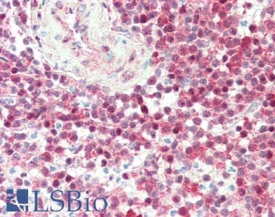 IHC-plus™ Polyclonal Rabbit anti-Human FKBP4 / FKBP52 Antibody (aa1-50, IHC, IF)