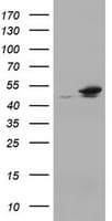 EPHX1 / Epoxide Hydrolase 1 Antibody (clone OTI3F10)