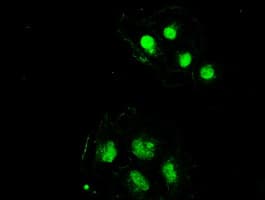 SSB / La Antibody (clone OTI2C8)